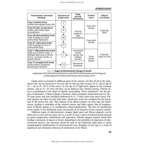 Internal Medicine: in 2 books. Book 1. Diseases of the Cardiovascular and Respiratory Systems: textbook / N.M. Seredyuk, I.P. Vakaliuk, R.I. Yatsyshyn et al.