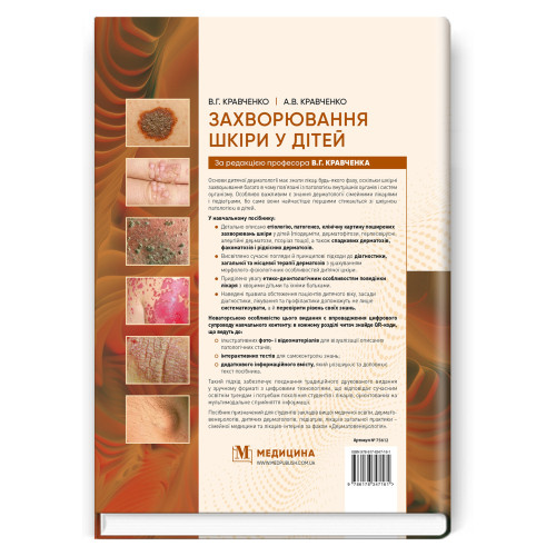 Захворювання шкіри у дітей / В.Г. Кравченко, А.В. Кравченко