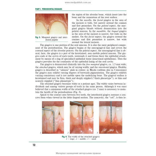 Periodontal and Oral Mucosa Diseases: in 2 volumes. — Volume 2: textbook (IV a. l.) / A.V. Borysenko, L.V. Lynovytska, О.F. Nesyn et al.; edited by A.V. Borysenko