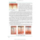 Periodontal and Oral Mucosa Diseases: in 2 volumes. — Volume 2: textbook (IV a. l.) / A.V. Borysenko, L.V. Lynovytska, О.F. Nesyn et al.; edited by A.V. Borysenko