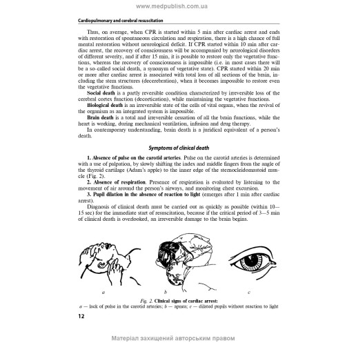 Anesthesiology and intensive care: textbook / F.S. Hlumcher, Yu.L. Kuchyn, S.O. Dubrov et al. — 3rd edition