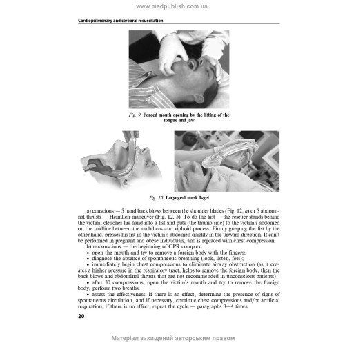 Anesthesiology and intensive care: textbook / F.S. Hlumcher, Yu.L. Kuchyn, S.O. Dubrov et al. — 3rd edition