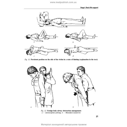 Anesthesiology and intensive care: textbook / F.S. Hlumcher, Yu.L. Kuchyn, S.O. Dubrov et al. — 3rd edition