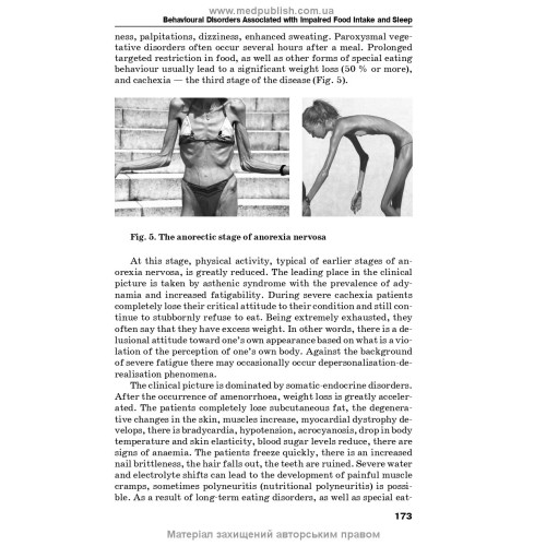 Psychiatry and Narcology: textbook / H.M. Kozhyna, Т.S. Mishchenko, N.O. Maruta et al.