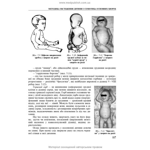 Педіатрія з курсом інфекційних хвороб: підручник / Л.В. Беш, В.I. Бельдій, Л.П. Дедишин та ін. — 9-е видання