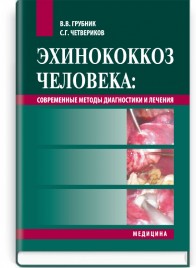 Эхинококкоз человека: Современные методы диагностики и лечения: монография / В.В. Грубник, С.Г. Четвериков, П.П. Шипулин
