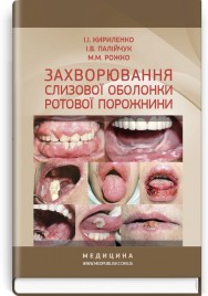 Захворювання слизової оболонки ротової порожнини: навчальний посібник (ВНЗ IV р. а.) / І.І. Кириленко, І.В. Палійчук, М.М. Рожко
